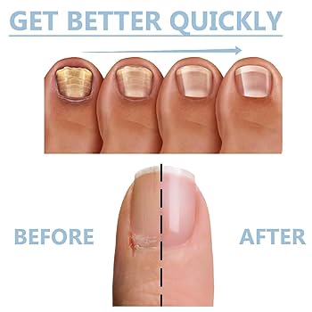 gid://shopify/MediaImage/30333514317924